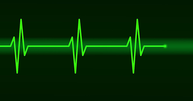 an ecg line